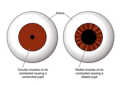 hippus pupil reaction causes